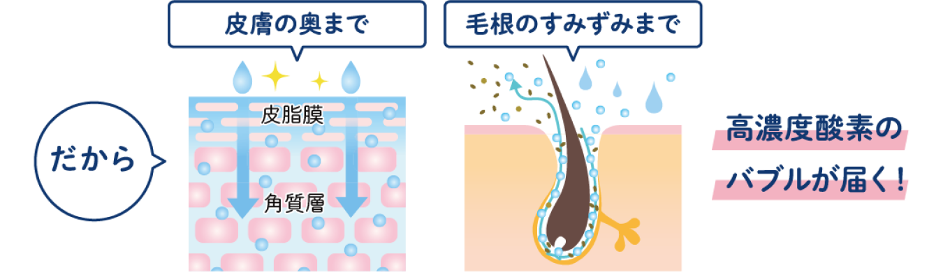 シングルナノバブル