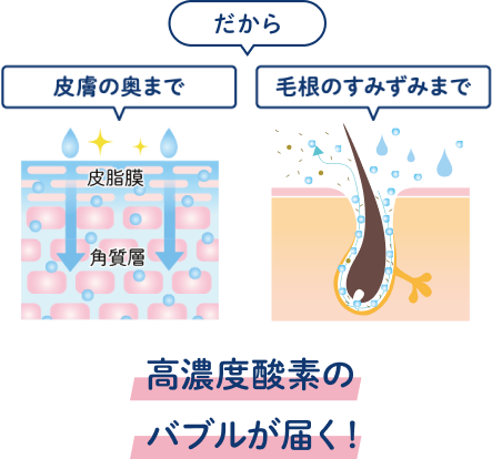 シングルナノバブル
